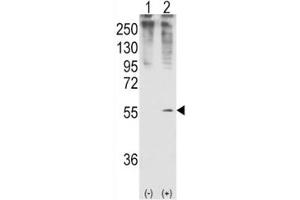 Western blot analysis of GDF11 antibody and 293 cell lysate (2 ug/lane) either nontransfected (Lane 1) or transiently transfected with the GDF11 gene (2).