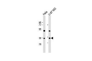 All lanes : Anti-HSTK12 Antibody (L21) at 1:2000 dilution Lane 1: Hela whole cell lysate Lane 2: U-87 MG whole cell lysate Lysates/proteins at 20 μg per lane. (Aurora-B (ARK/STK12) (AA 6-35), (N-Term) antibody)