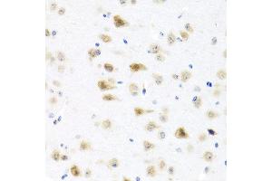 Immunohistochemistry of paraffin-embedded mouse brain using C8orf4 antibody at dilution of 1:100 (40x lens). (C8orf4 antibody)