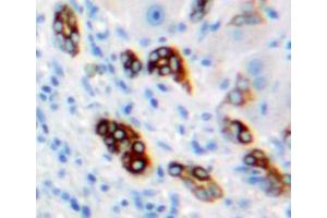 Used in DAB staining on fromalin fixed paraffin-embedded liver tissue (CA9 antibody  (AA 59-414))