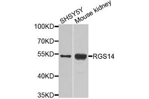 Western blot analysis of extracts of various cell lines, using RGS14 antibody. (RGS14 antibody)