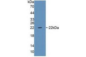 Detection of Recombinant PTPRZ, Human using Polyclonal Antibody to Protein Tyrosine Phosphatase Receptor Type Z (PTPRZ) (Protein Tyrosine Phosphatase Receptor Type Z (AA 32-189) antibody)