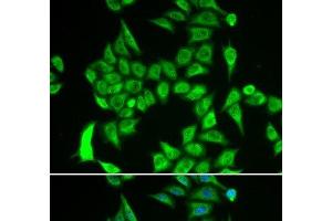 Immunofluorescence analysis of A549 cells using IREB2 Polyclonal Antibody (IREB2 antibody)