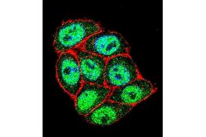 Confocal immunofluorescent analysis of p16INK4a Antibody (C-term ) (ABIN1981278 and ABIN2845115) with Hela cell followed by Alexa Fluor 488-conjugated goat anti-rabbit lgG (green). (CDKN2A antibody  (C-Term))