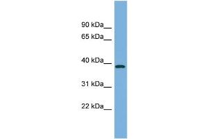WB Suggested Anti-FBP2 Antibody Titration:  0. (FBP2 antibody  (Middle Region))