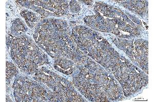 IHC analysis of Poliovirus Receptor/PVR using anti-Poliovirus Receptor/PVR antibody (ABIN7601072).