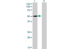 Western Blot analysis of ZNF213 expression in transfected 293T cell line by ZNF213 monoclonal antibody (M01), clone 5D7. (ZNF213 antibody  (AA 133-242))