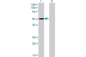 Western Blot analysis of ZNF213 expression in transfected 293T cell line by ZNF213 monoclonal antibody (M01), clone 5D7.