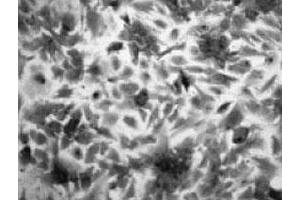 Imunohistochemical analysis of rat brain astrocyte, using Slc22a3 polyclonal antibody  . (SLC22A3 antibody)