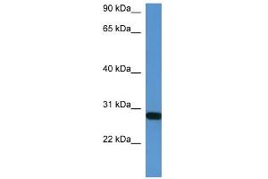 WB Suggested Anti-Hoxb1 Antibody Titration:  0. (HOXB1 antibody  (C-Term))