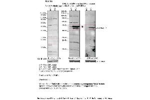 Sample Type: 1. (RAB3A antibody  (C-Term))