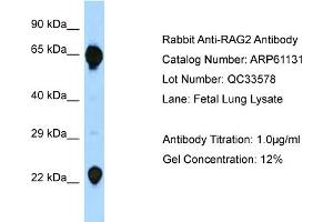Western Blotting (WB) image for anti-Recombination Activating Gene 2 (RAG2) (C-Term) antibody (ABIN2788687)