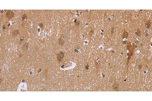 Immunohistochemistry of paraffin-embedded Human brain using GABPB2 Polyclonal Antibody at dilution of 1:30 (GABPB2 antibody)