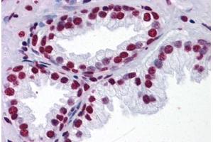 Human Prostate: Formalin-Fixed, Paraffin-Embedded (FFPE) (THOC6 antibody  (AA 71-181))