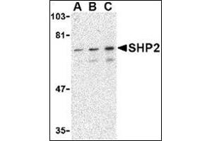 Western blot analysis of SHP2 in mouse skeletal muscle tissue lysate with this product at (A) 0. (PTPN11 antibody  (C-Term))