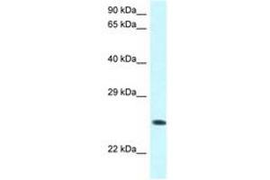 Image no. 1 for anti-WW Domain Containing Oxidoreductase (WWOX) (AA 95-144) antibody (ABIN6747534) (WWOX antibody  (AA 95-144))