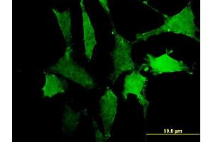 Immunofluorescence of monoclonal antibody to SIRPA on NIH/3T3 cell. (SIRPA antibody  (AA 28-507))