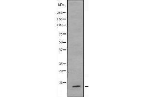 Western blot analysis of extracts from HeLa cells, using TUSC2 antibody.