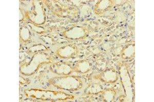 Immunohistochemistry of paraffin-embedded human kidney tissue using ABIN7170187 at dilution of 1:100 (SLC25A35 antibody  (AA 120-168))