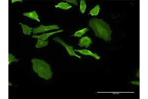 Immunofluorescence of monoclonal antibody to DHRS9 on HeLa cell. (DHRS9 antibody  (AA 1-319))