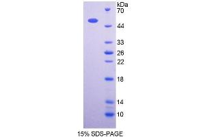 SDS-PAGE (SDS) image for 3-Oxoacid CoA Transferase 1 (OXCT1) (AA 40-489) protein (His tag) (ABIN4990703)