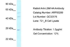 WB Suggested Anti-LSM14A Antibody Titration: 0. (LSM14A antibody  (C-Term))