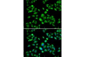 Immunofluorescence analysis of U2OS cells using MBTPS1 antibody. (MBTPS1 antibody)