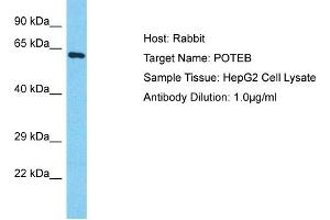 Host: Rabbit Target Name: POTEB Sample Type: HepG2 Whole Cell lysates Antibody Dilution: 1. (POTEB antibody  (C-Term))