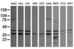 Image no. 1 for anti-Mitogen-Activated Protein Kinase 9 (MAPK9) antibody (ABIN1498930) (JNK2 antibody)