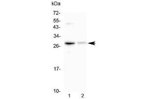 Western blot testing of 1) mouse HEPA1-6 and 2) rat kidney lysate with Oncostatin M antibody at 0.
