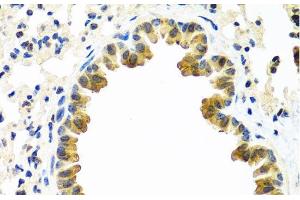 Immunohistochemistry of paraffin-embedded Mouse lung using CRTAP Polyclonal Antibody at dilution of 1:100 (40x lens).