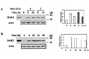 Effect of gamma-irradiation and IFN-beta on IP6K2 protein levels.
