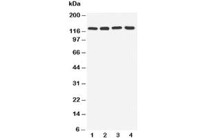 Western blot testing of TLR7 antibody and Lane 1:  rat spleen (TLR7 antibody  (C-Term))