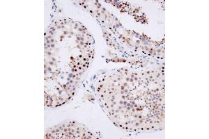 Immunohistochemical analysis of (ABIN1539554 and ABIN2849696) on paraffin-embedded human testis tissue was performed on the Leica®BOND RXm. (OTUD7A antibody  (N-Term))