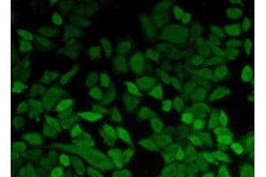 Detection of PGK1 in Hela cells using Polyclonal Antibody to Phosphoglycerate Kinase 1 (PGK1) (PGK1 antibody  (AA 2-417))