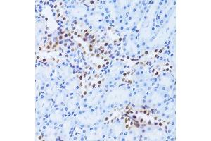 Immunohistochemistry (Paraffin-embedded Sections) (IHC (p)) image for anti-Acidic (Leucine-Rich) Nuclear phosphoprotein 32 Family, Member A (ANP32A) (AA 1-170) antibody (ABIN6136909)