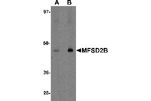 Western blot analysis of MFSD2B in rat lung tissue lysate with MFSD2B antibody at (A) 1 and (B) 2 µg/mL. (MFSD2B antibody  (Middle Region))