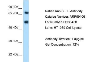 WB Suggested Anti-SELE Antibody Titration: 0. (Selectin E/CD62e antibody  (N-Term))