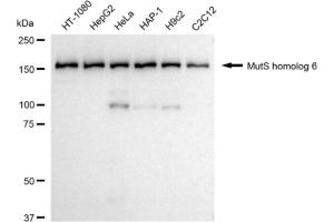 Western blotting analysis using MutS homolog 6 antibody (ABIN7799501).