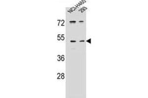 Western Blotting (WB) image for anti-Protease, Serine, 55 (PRSS55) antibody (ABIN2996346)
