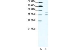 Western Blotting (WB) image for anti-Microphthalmia-Associated Transcription Factor (MITF) antibody (ABIN2461619) (MITF antibody)