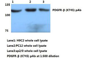 Western blot (WB) analyzes of PDGFR-β antibody (PDGFRB antibody)