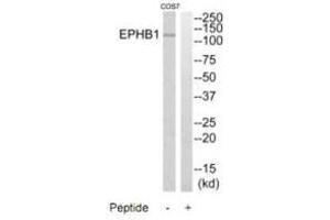 Western blot analysis of extracts from COS7 cells, using EPHB1 antibody. (EPH Receptor B1 antibody  (C-Term))