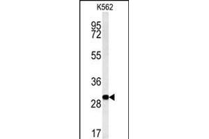 Western blot analysis of C3orf75 Antibody (C-term) (ABIN651356 and ABIN2840198) in K562 cell line lysates (35 μg/lane). (ELP6 antibody  (C-Term))