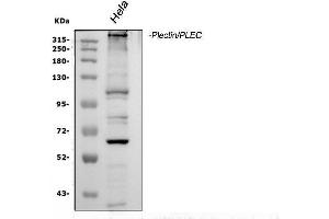 Western blot analysis of Plectin using anti-Plectin antibody (ABIN3043900). (PLEC antibody  (Middle Region))
