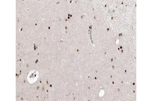 ABIN6266648 at 1/100 staining human brain tissue sections by IHC-P. (CDK7 antibody  (Internal Region))