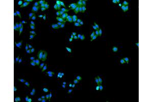Immunofluorescence analysis of HepG2 cells using SLC2A1 antibody (ABIN5997113). (GLUT1 antibody)