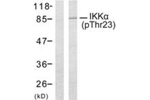 Western blot analysis of extracts from MDA-MB-435 cells treated with EGF, using IKK-alpha (Phospho-Thr23) Antibody.