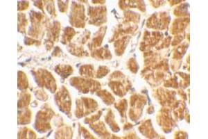 Immunohistochemical staining of human heart tissue using AP30264PU-N CX3CR1 antibody at 2 μg/ml. (CX3CR1 antibody  (N-Term))
