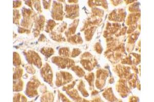 Immunohistochemical staining of human heart tissue using AP30264PU-N CX3CR1 antibody at 2 μg/ml.